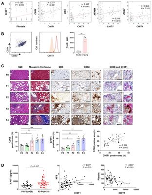 Chitinase 1: a novel therapeutic target in metabolic dysfunction-associated steatohepatitis